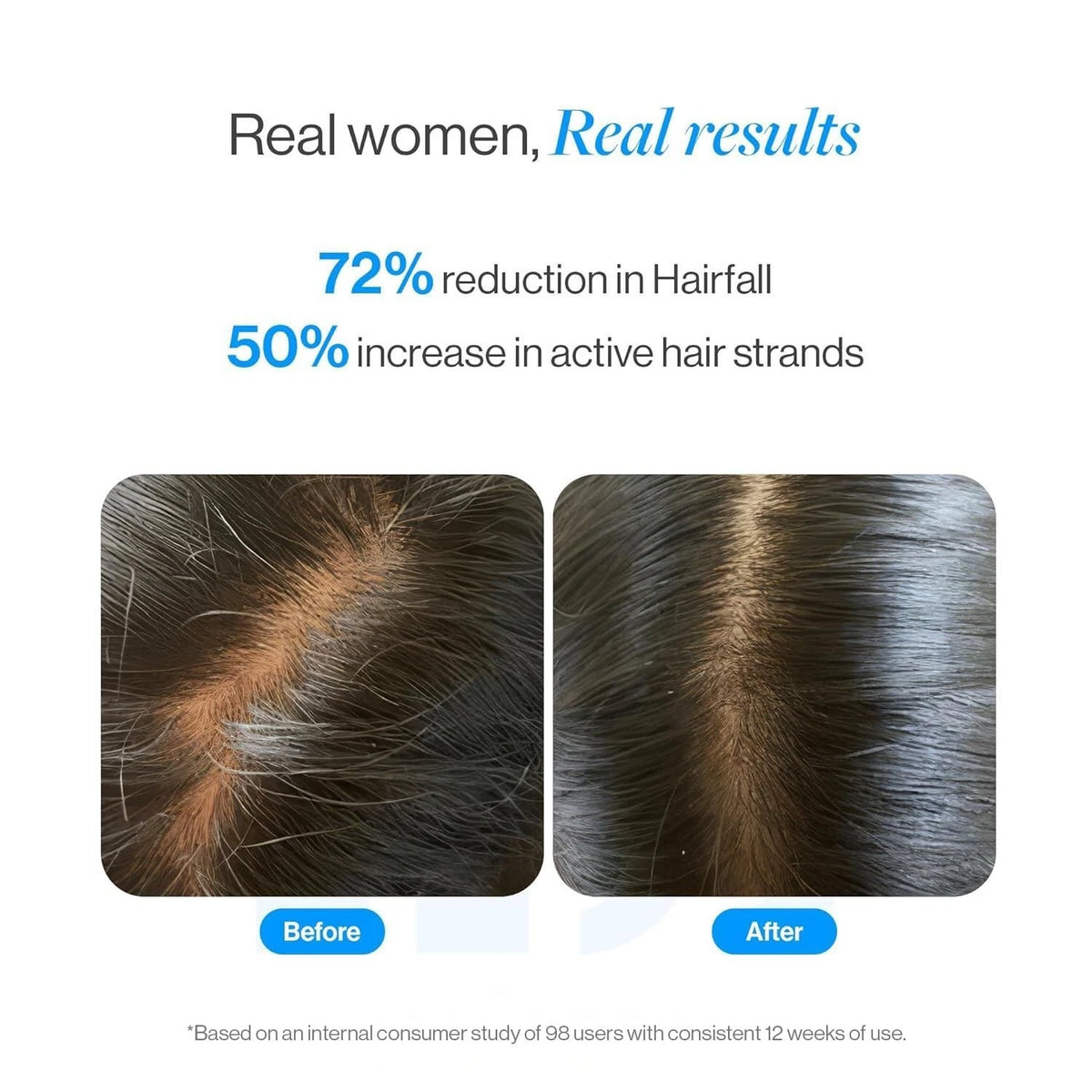 Bodywise Hair Growth Serun